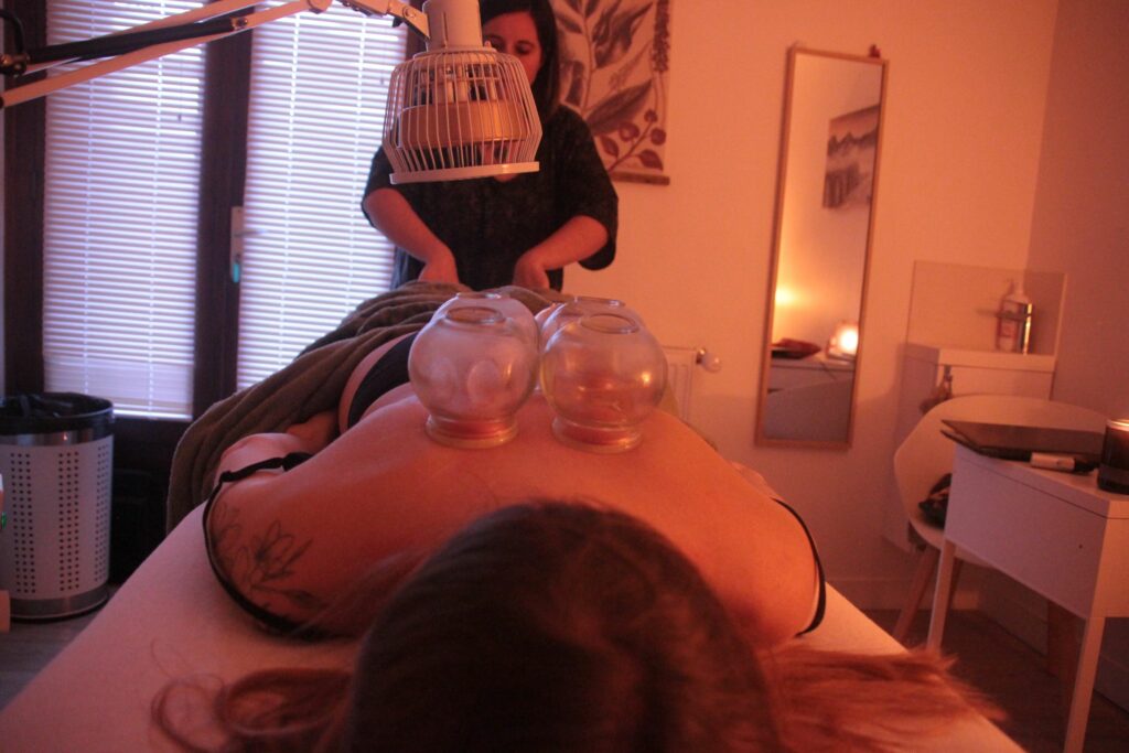 medecine-chinoise-ventouse